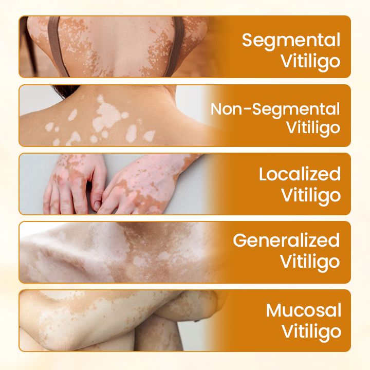 Final 3 Hours: 60% OFF🔥BBOJI™ VitiClear Pro Bee Toxin Cream