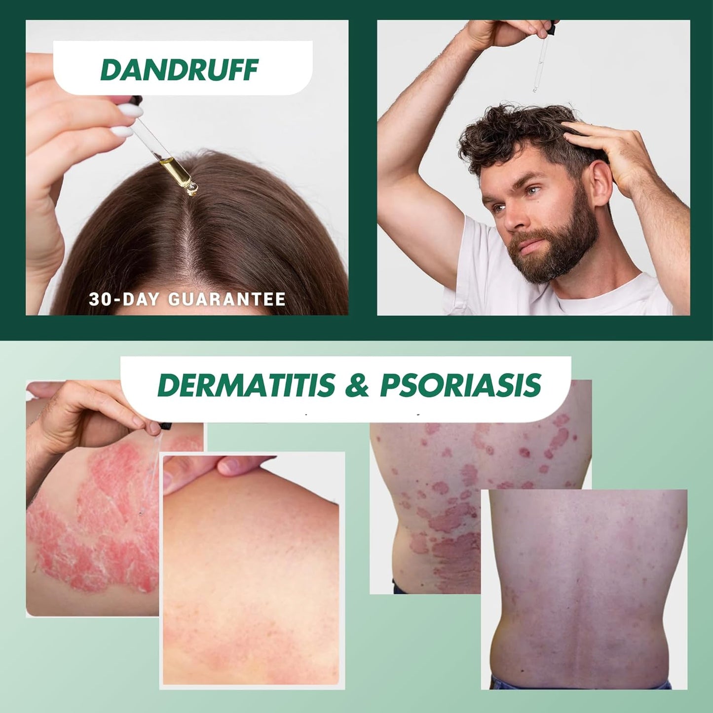 Slimoly®– Fast Relief for Your Skin