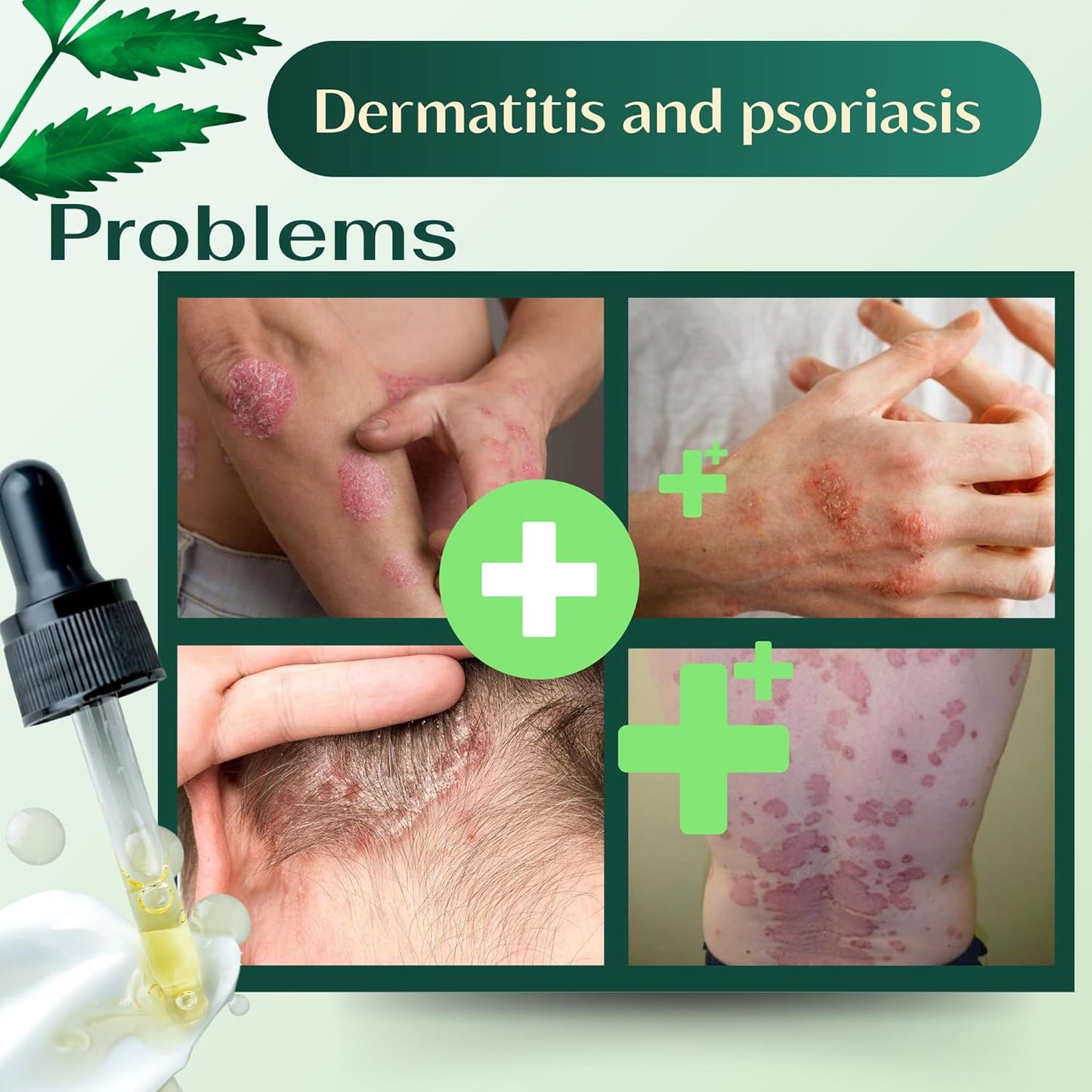 Slimoly®– Fast Relief for Your Skin