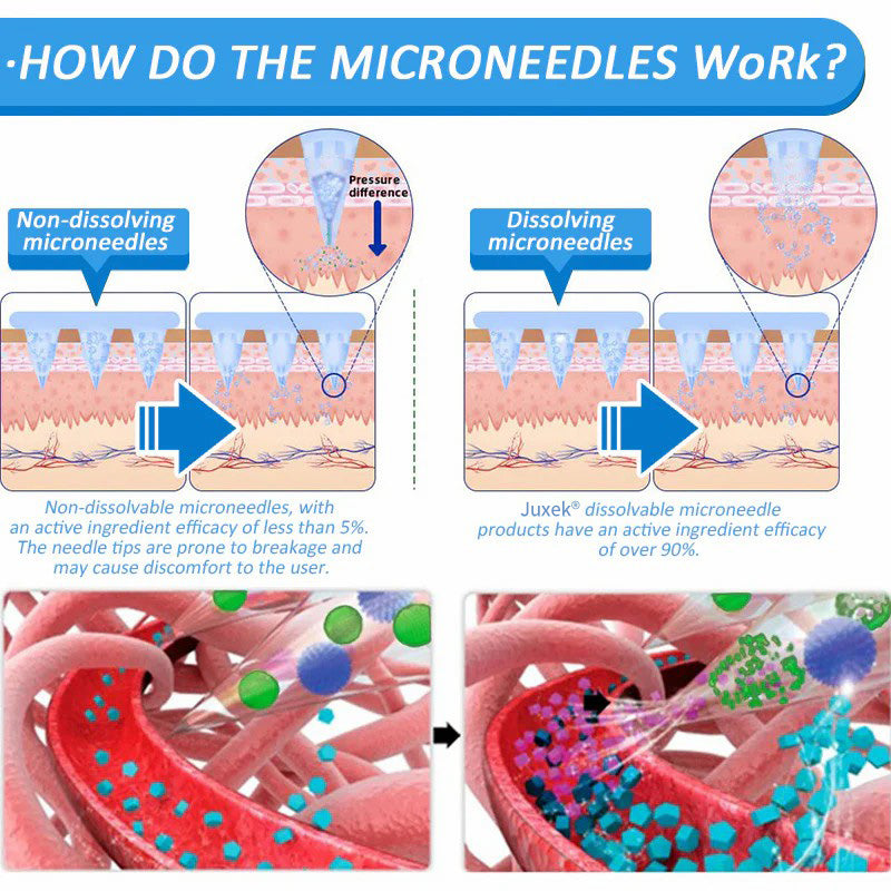 Juxek® SMGT-GLP-1 Nano Microneedle Patch