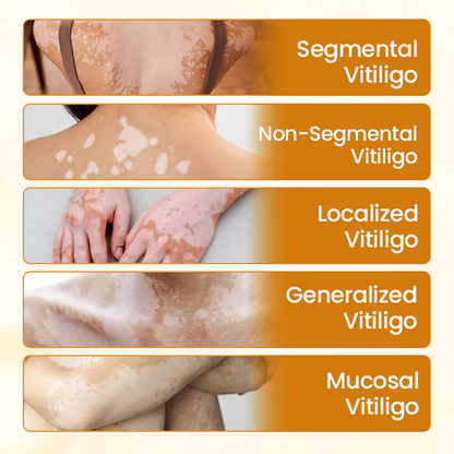 Final 3 Hours: 60% OFF🔥BBOJI™ VitiClear Pro Bee Toxin Cream