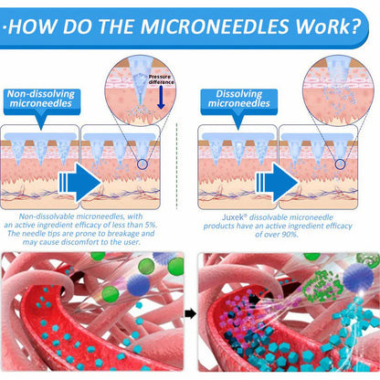 Juxek® SMGT-GLP-1 Nano Microneedle Patch